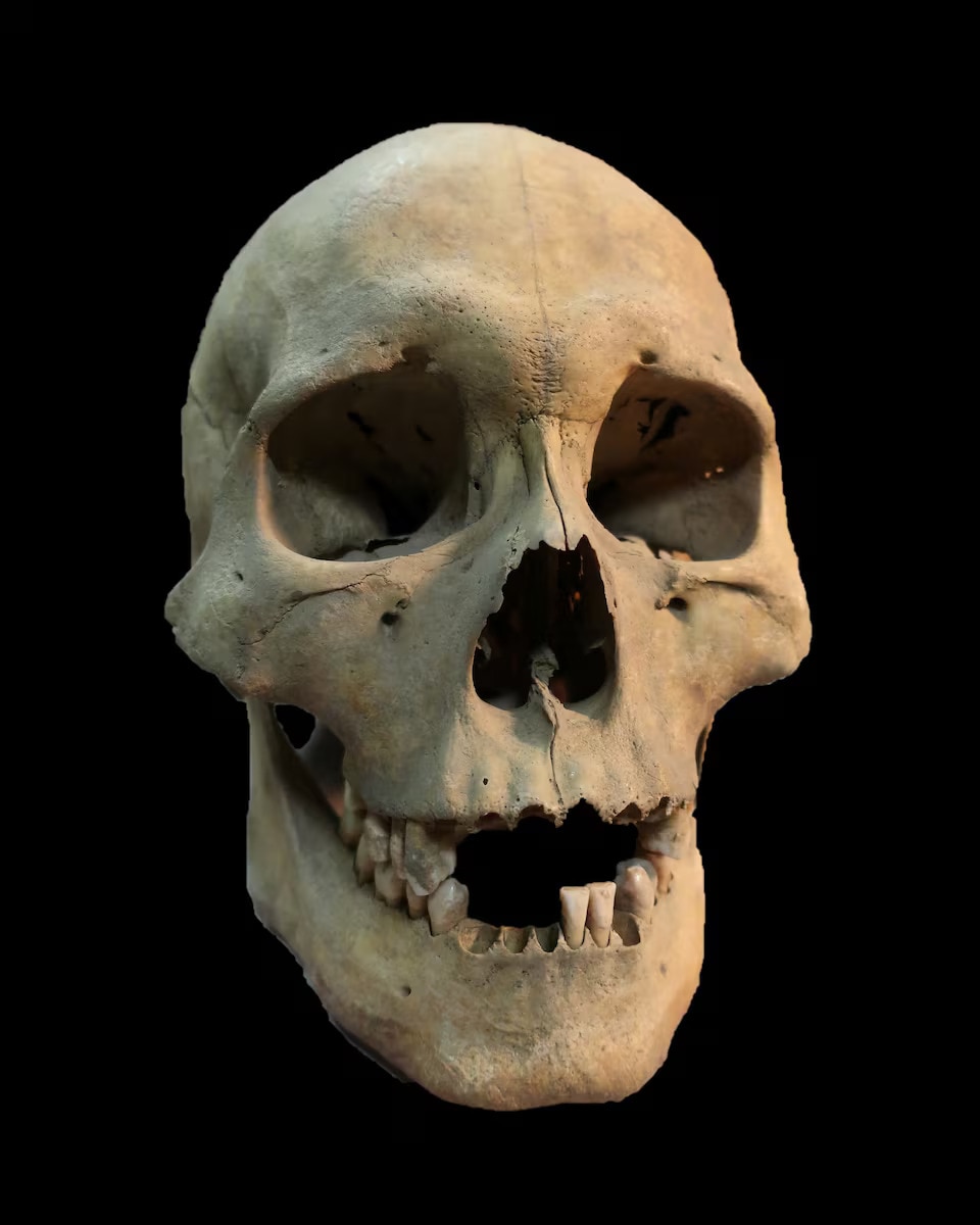 The skull of a hunter-gatherer woman estimated to have been 25-35 years old. (Photo: Reuters)