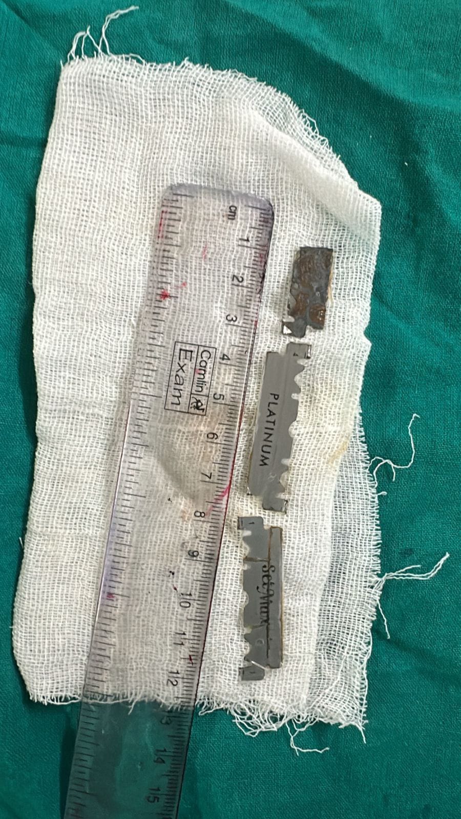 Hyderabad doctors remove 3 razor blade pieces from teenâs stomach in risky procedure