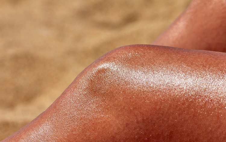 A close-up of sun-burned skin due to prolonged exposure to UV radiation. (Photo: Unsplash)