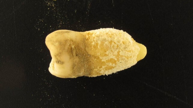 The tooth of a Bolivian mummy. (Photo: Eurac Research/Guido Valverde)