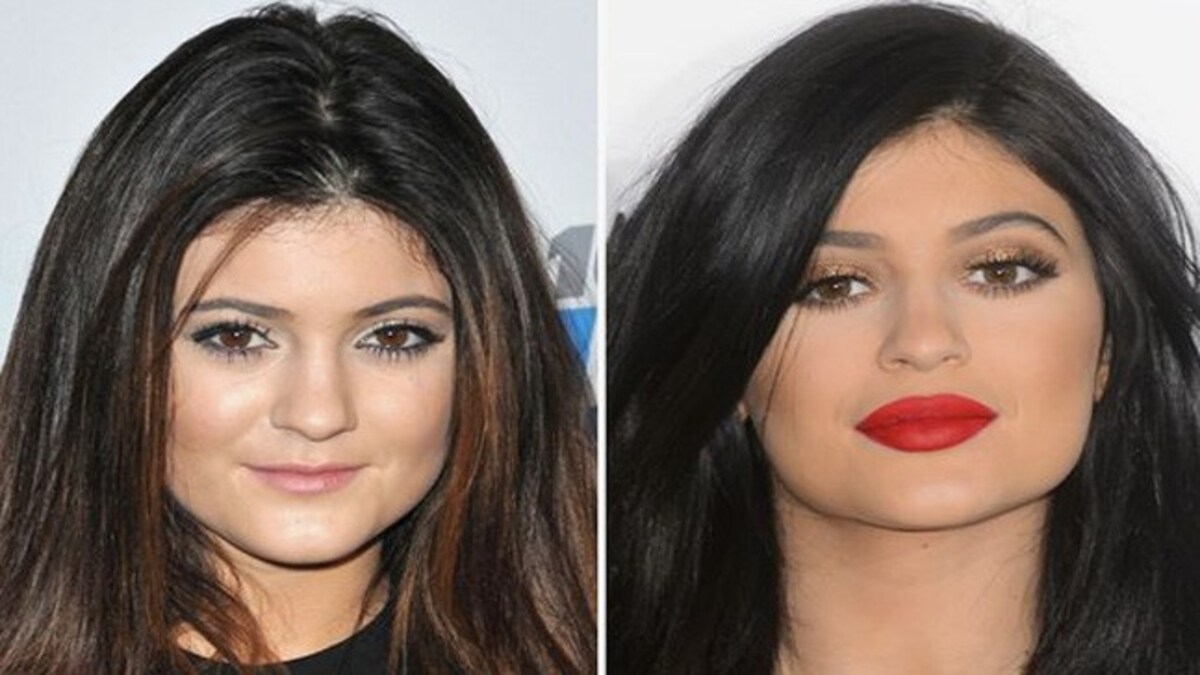 Maybe Kylie Jenner Did Not Need A Lip Job At Least Not For This Reason Lifestyle News