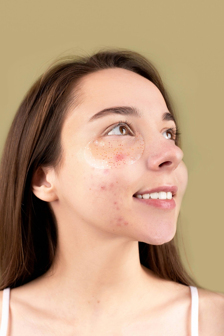 If not used correctly, silicone tape can cause acne. Photo: Unsplash
