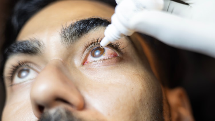 Harmful substances can harm the eye tears. (Photo: Getty Image)