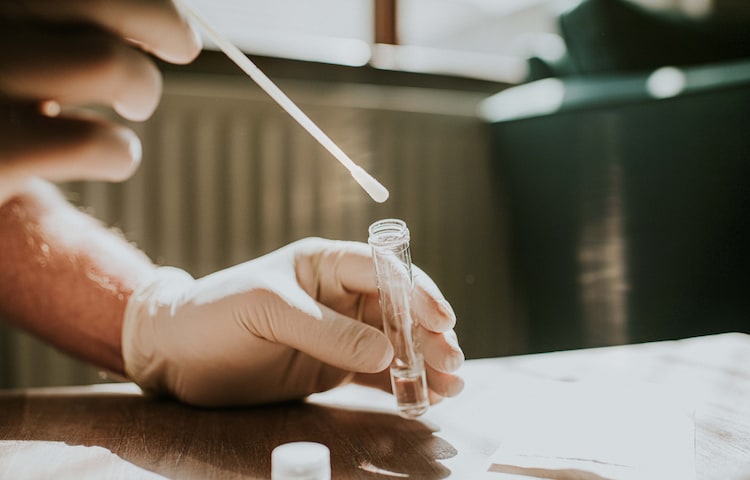 More people are testing at home instead of visiting hospitals. (Photo: Getty Image)
