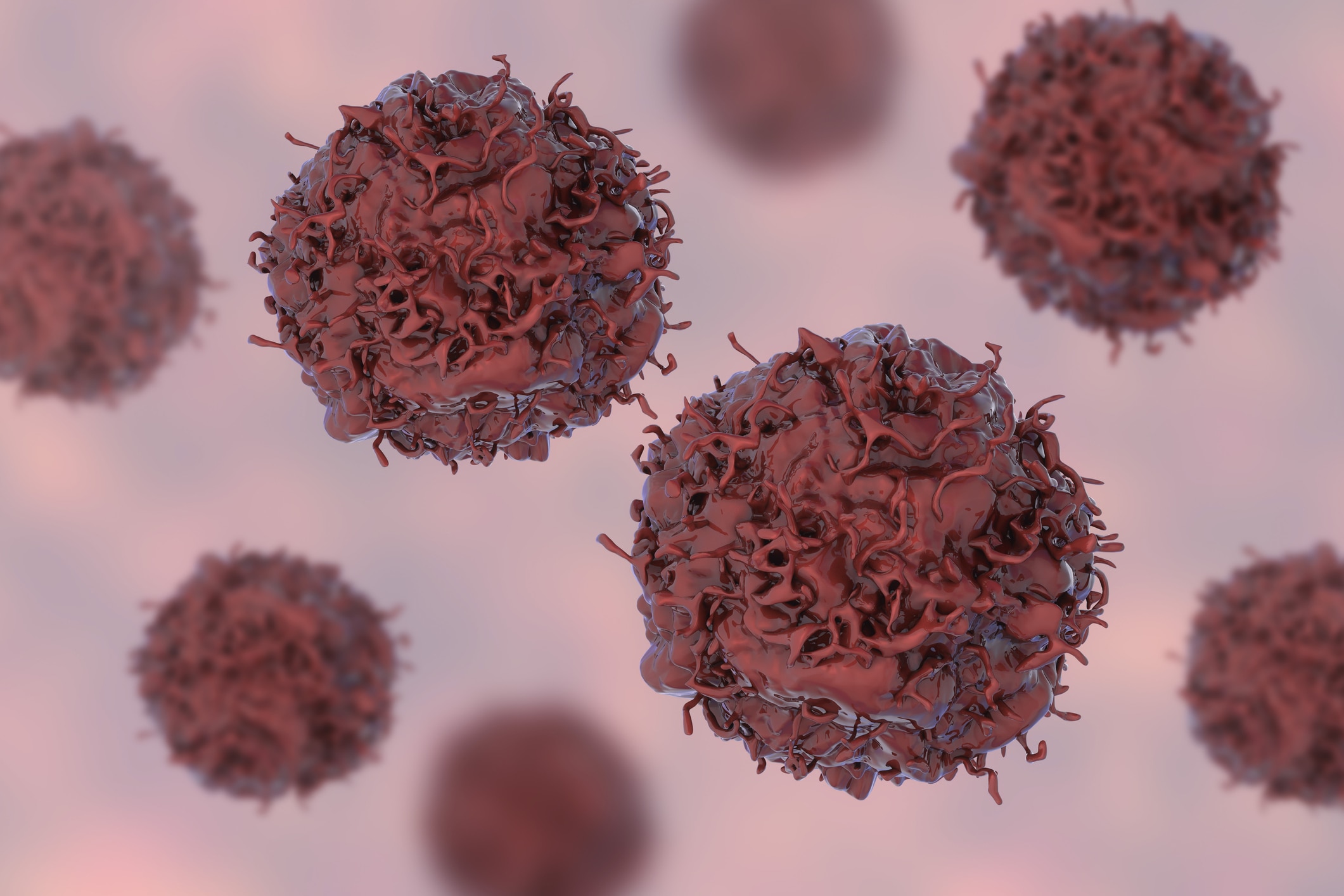 Among the large metropolitan cities, Delhi had the highest cancer rate in men, while Srinagar reported the most incidents of lung cancer. (Photo: Getty Image)