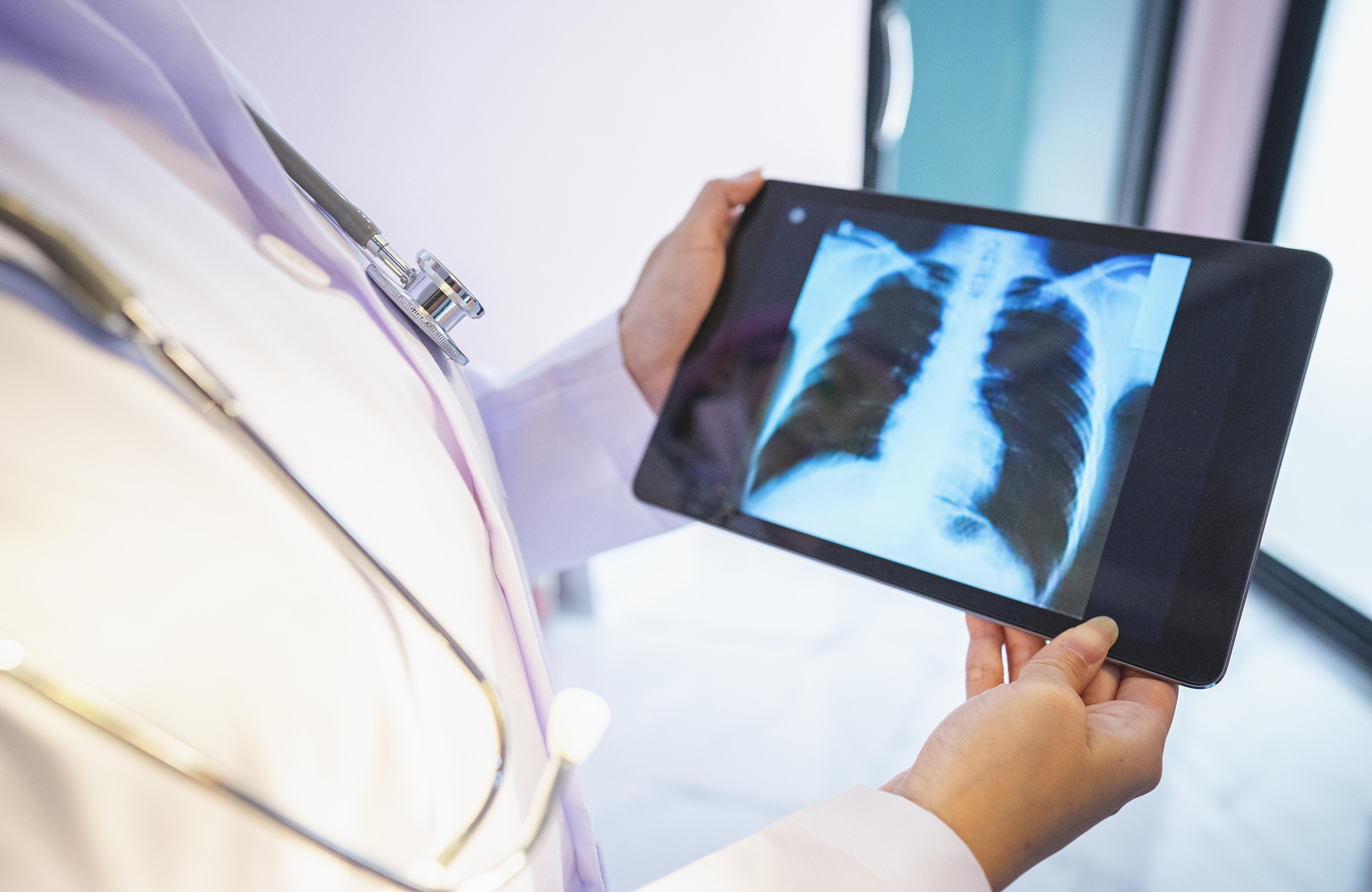 In Ahmedabad, there was an increase of 4.7% in oral cancer in men and 6.9% in women. (Photo: Getty Image)