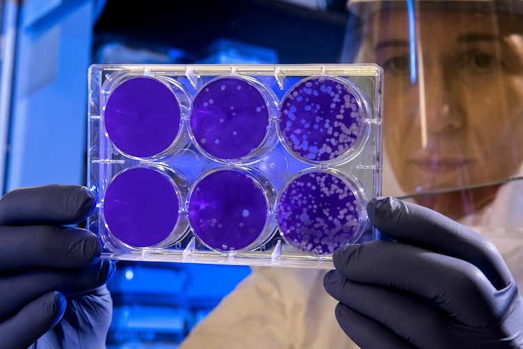Stem cells are master cells that can grow into any type of blood cell. The bone marrow is the spongy tissue inside bones where these cells are made. (Photo: Unsplash)