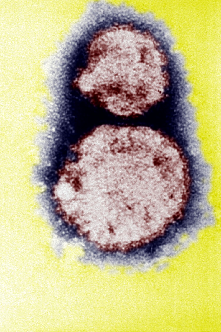 The incubation period for hantavirus ranges from one to six weeks, making it difficult for health authorities to identify exposures early. (Photo: Getty Images)