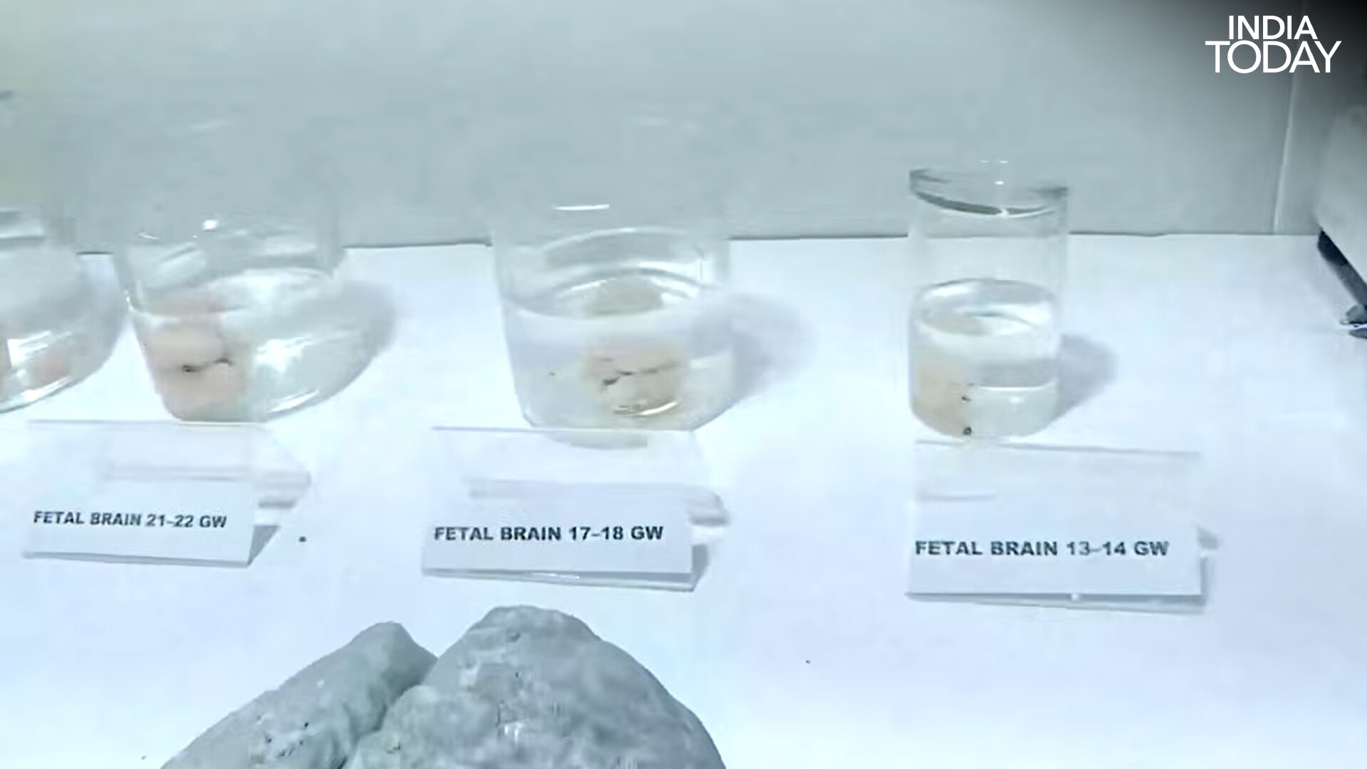 Inside the brain-mapping lab at IIT Madras, human brains at different stages of development, part of an effort to chart the organ cell by cell. (Photo: Radifah Kabir/India Today)