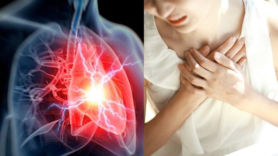 Heart Attack Signs