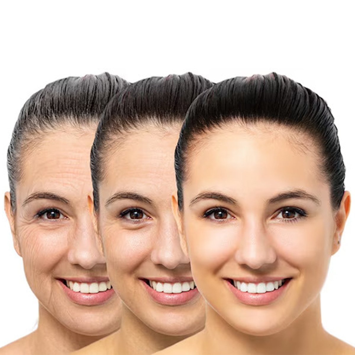 Wrinkles solution