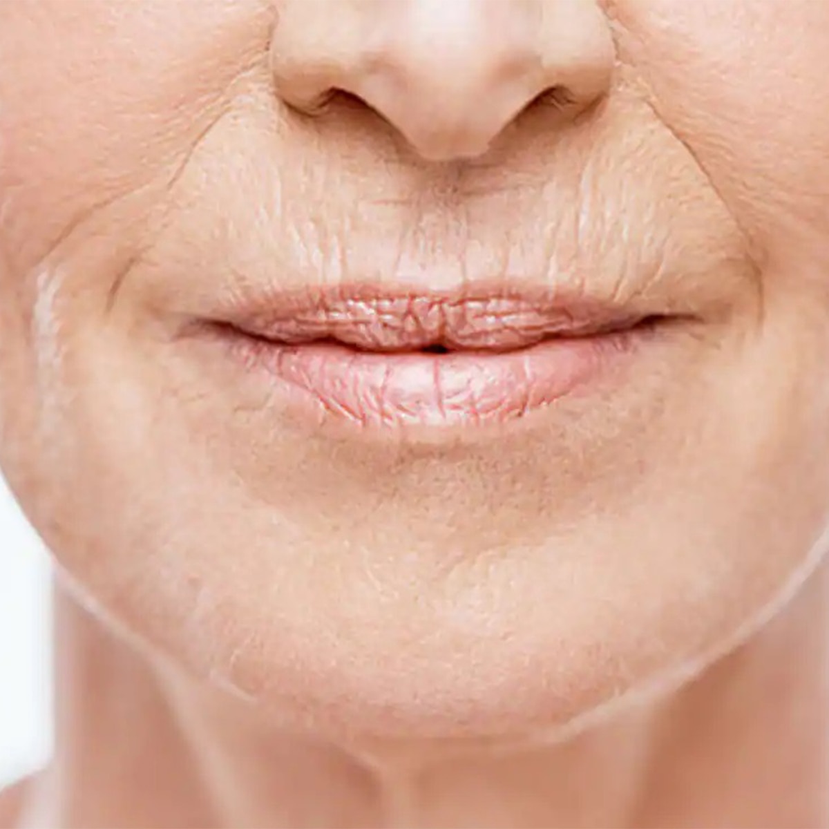 Wrinkle