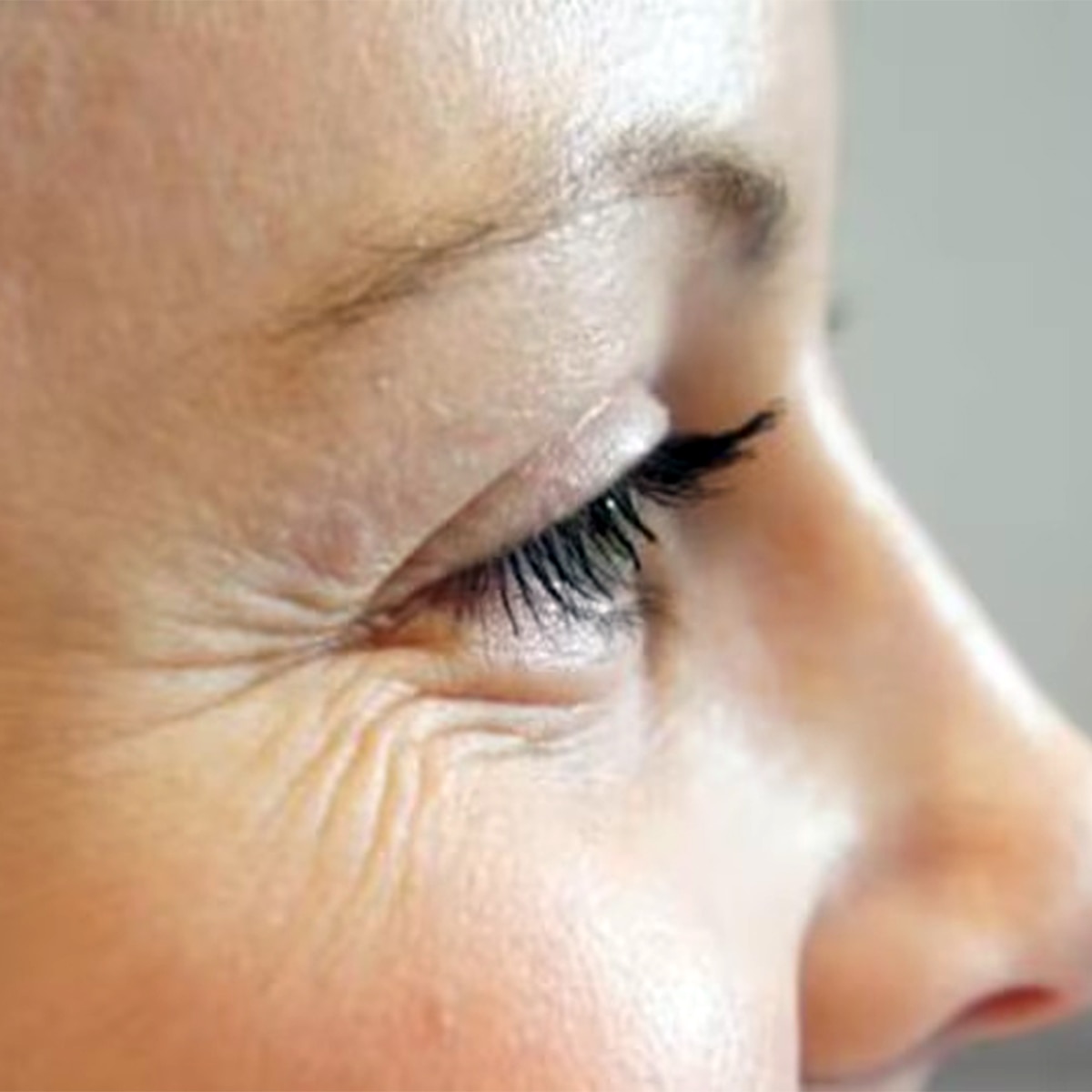 Wrinkles 