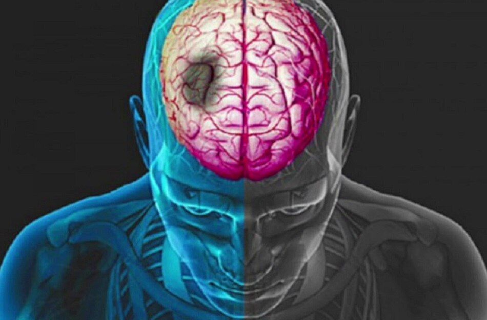 বদভ্যাস, বদভ্যাস,