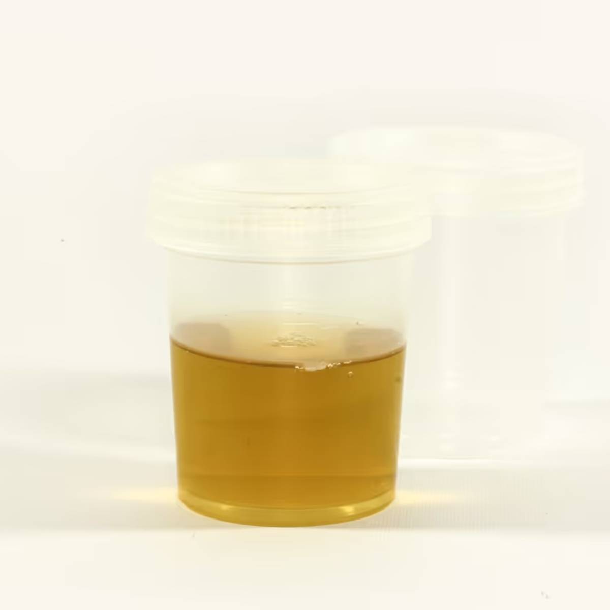 তাই, এই সমস্ত বিষয়ের প্রতি বিশেষ মনোযোগ দেওয়া উচিত, কারণ অনেক সময় আমরা নিজেরাই অজান্তে আমাদের কিডনির ক্ষতি করতে শুরু করি। তাই, এই সমস্ত বিষয়ের প্রতি বিশেষ মনোযোগ দেওয়া উচিত, কারণ অনেক সময় আমরা নিজেরাই অজান্তে আমাদের কিডনির ক্ষতি করতে শুরু করি।