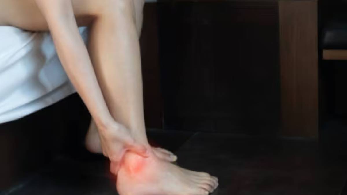 অনেকের শরীরেই ইউরিক অ্যাসিড বেশি থাকে