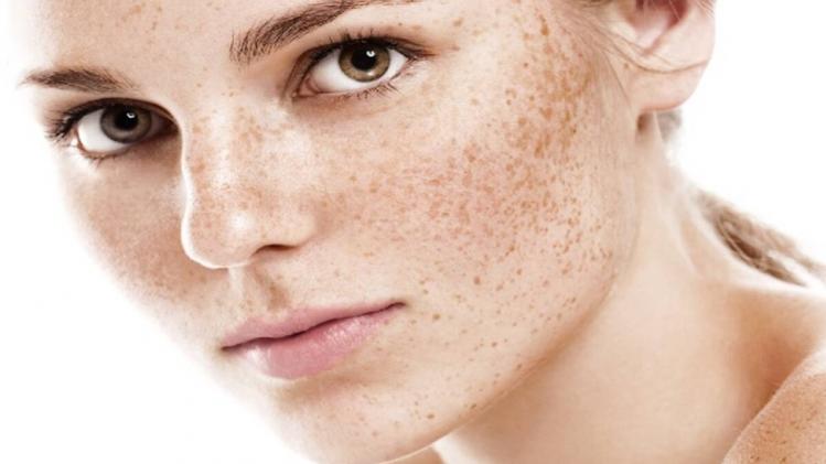Reasons Of Pigmentation: ৫ ভুলেই মুখে কালো ছোপ, চটজলদি গ্ল্যামার