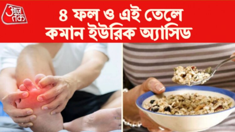 Uric Acid Control Tips ৪ ফল ও এই তেলেই জব্দ ইউরিক অ্যাসিড, আর কতক্ষণ