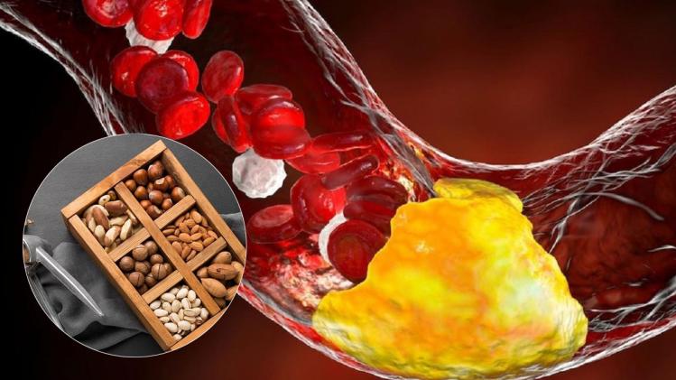 Dry Fruits Reduce Cholesterol খারাপ কোলেস্টেরল কমাতে দারুণ কার্যকরী