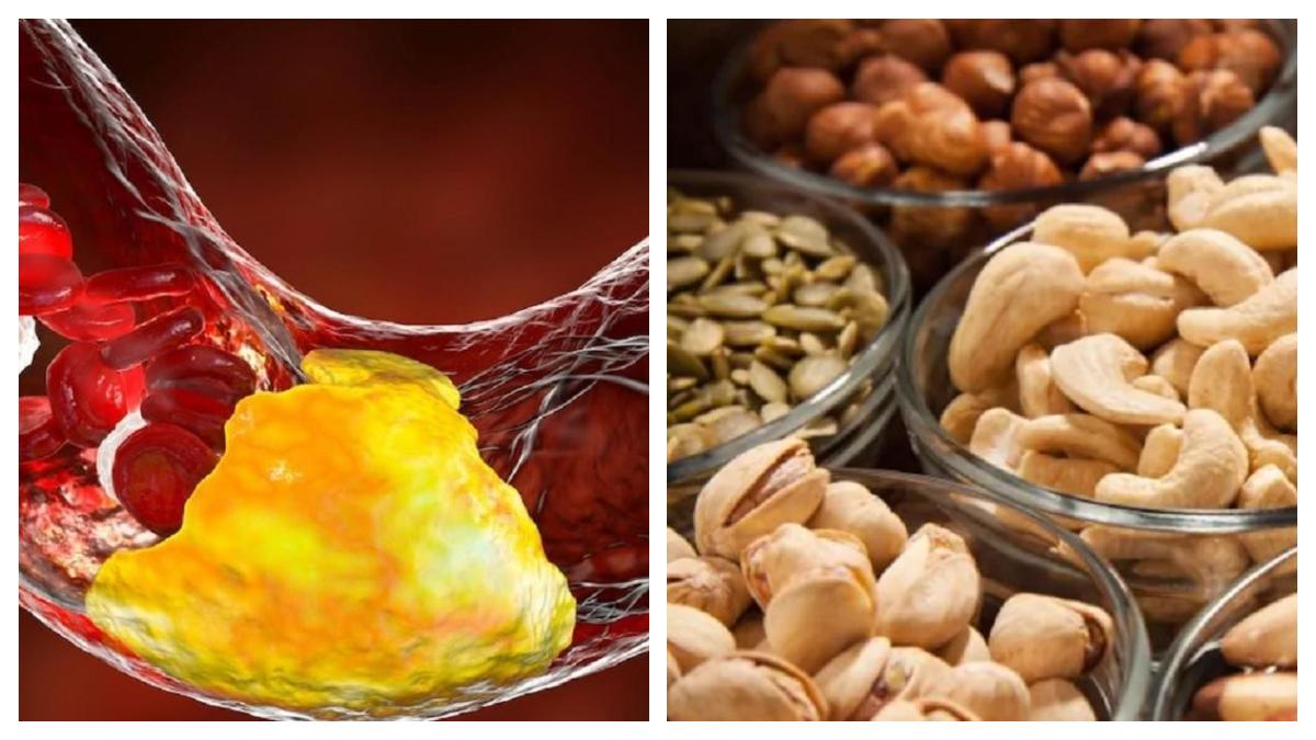 Cholesterol Control Dry Fruits ৫ ড্রাই ফ্রুটসেই নিয়ন্ত্রণে থাকবে