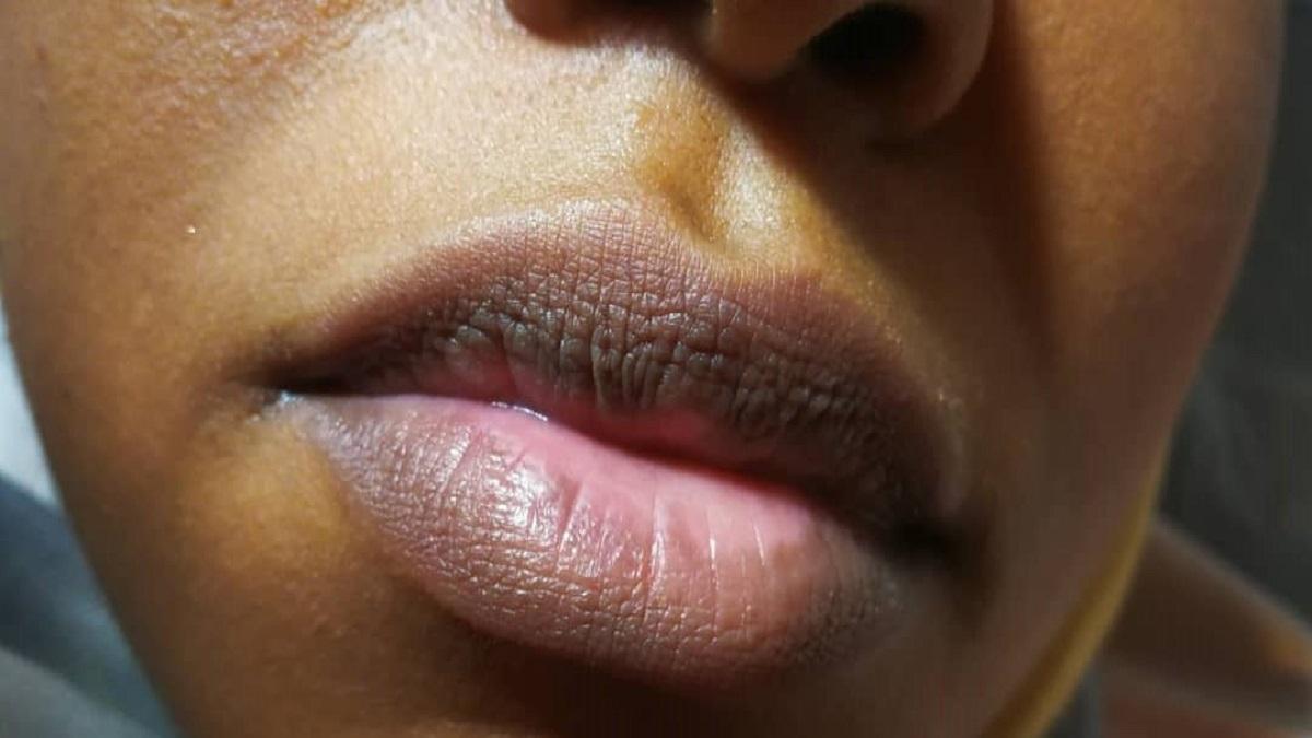 Lips Care ঠোঁট কালো হয়ে যাচ্ছে? জানুন কোন বদঅভ্যাস কারণ হতে পারে