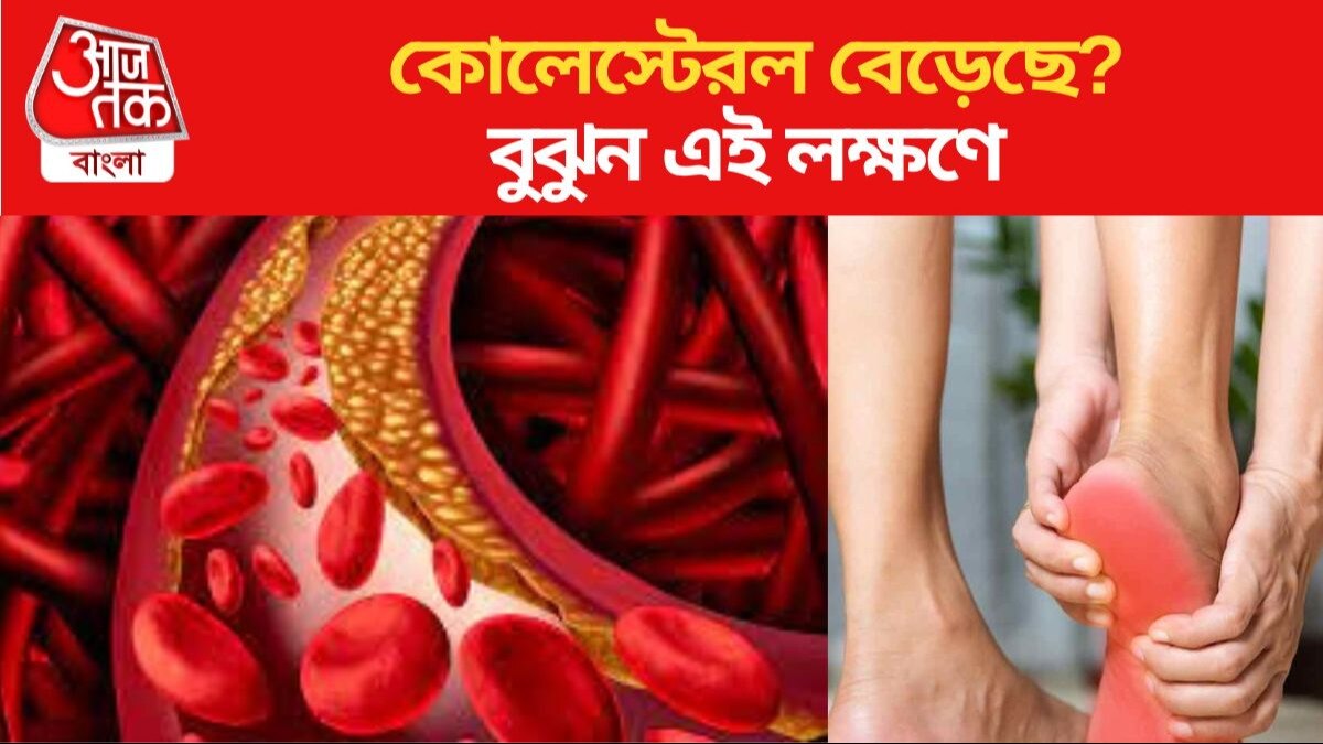 Cholesterol কোলেস্টেরল বেড়েছে? দেহের এই অঙ্গগুলির অসহ্য ব্যথাই