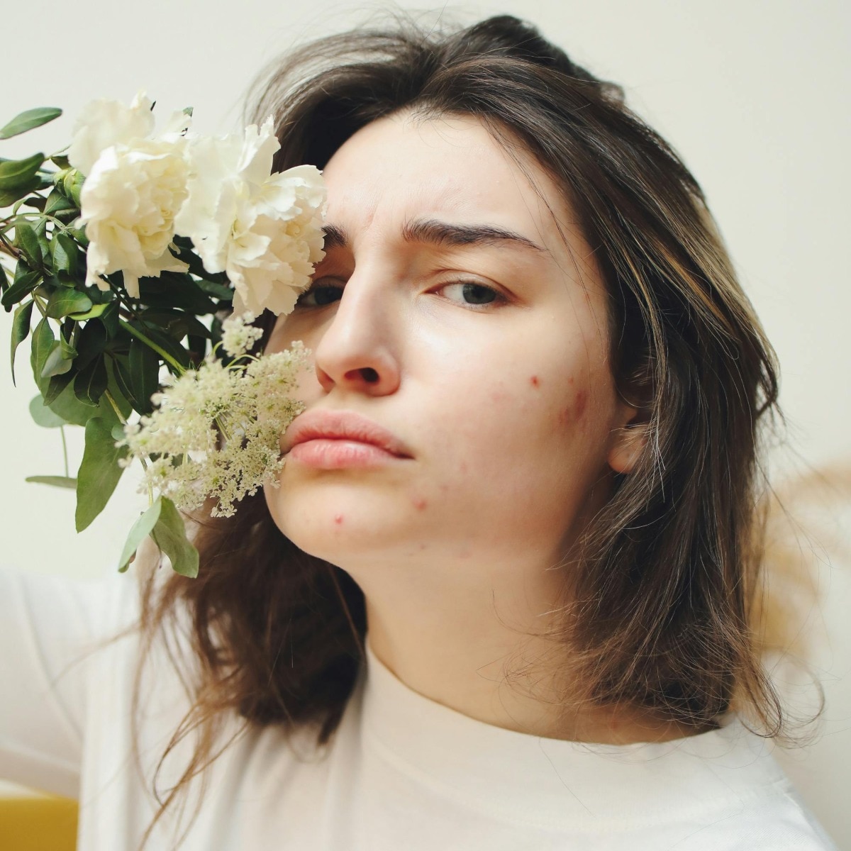 Acne, meet your match—K-beauty saviours that every acne-prone girl needs in 2025