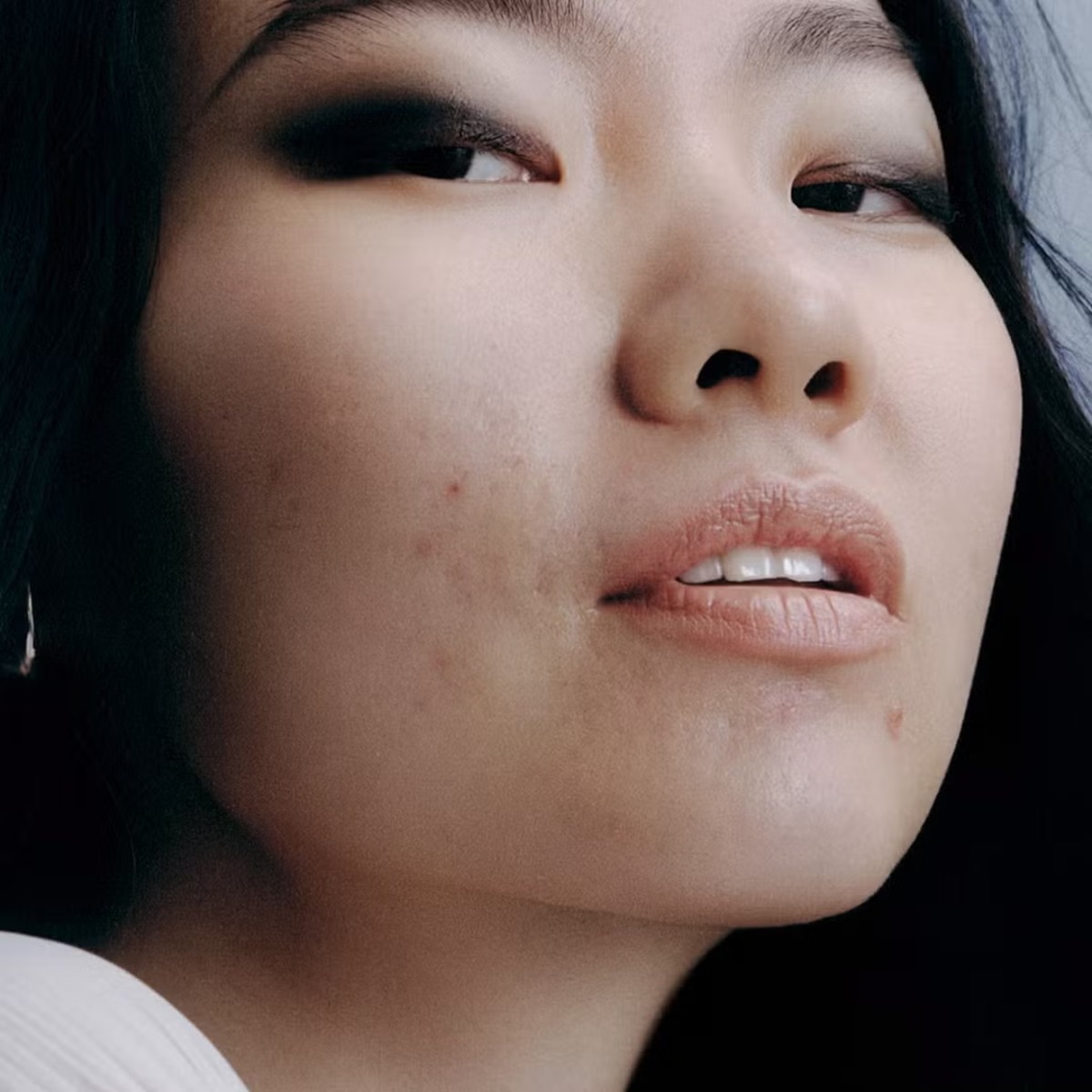 Behold: The best skincare routine for acne in 2025, according to dermatologists
