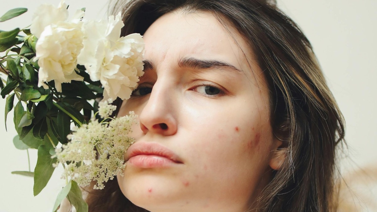 Dermatologists break down exactly why your luteal phase wreaks havoc on your skin