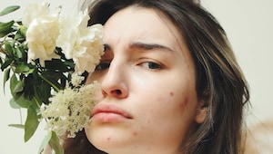 Dermatologists break down exactly why your luteal phase wreaks havoc on your skin Dermatologists break down exactly why your luteal phase wreaks havoc on your skin