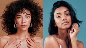 Everything you need to know about dark spots before you try to fade them Everything you need to know about dark spots before you try to fade them