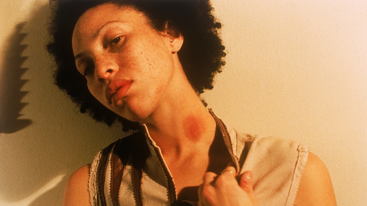 The internet is full of hickey hacks—experts say these tips actually help