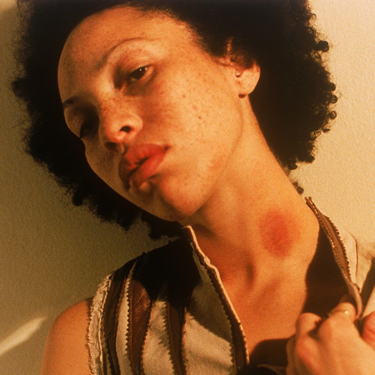 The internet is full of hickey hacks—experts say these tips actually help