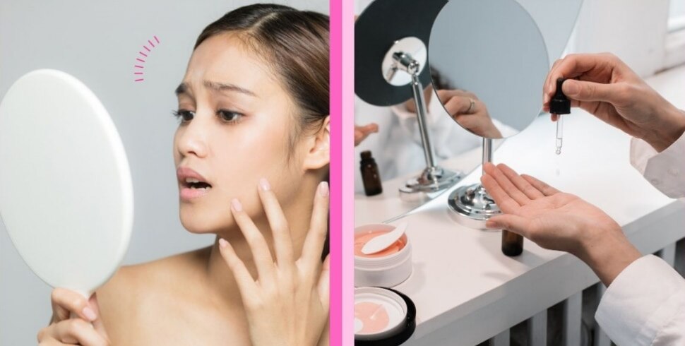 Avoid Using These Skincare Ingredients If You Have Oily, Acne-Prone Skin