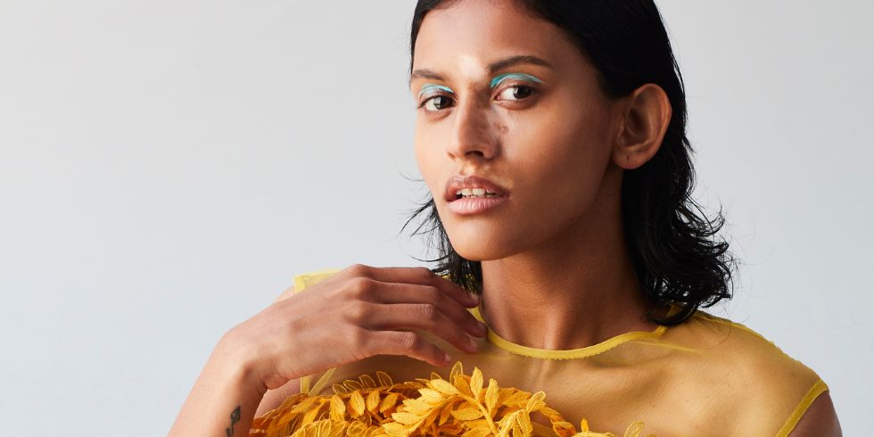 World Vitiligo Day: An Insight into the Disorder and How Living with it Can Be Empowering Too