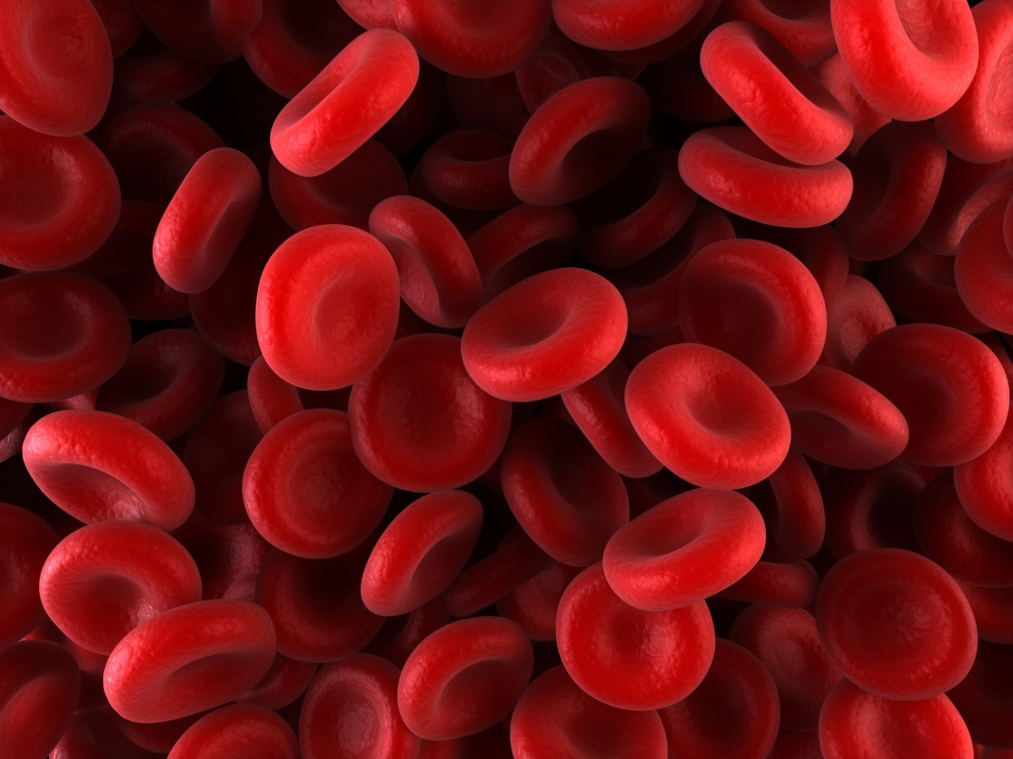 Anemia