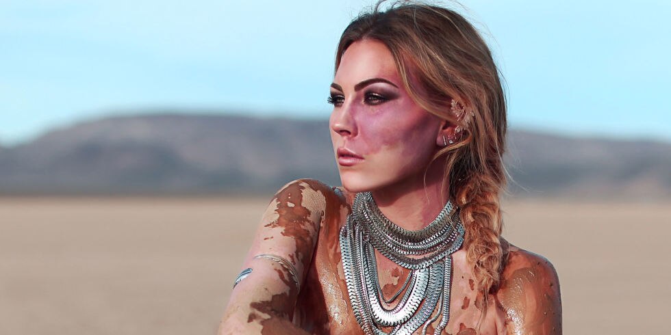 See 4 Stunning Photos of This 23-Year-Old Woman's Flawless Red Birthmark