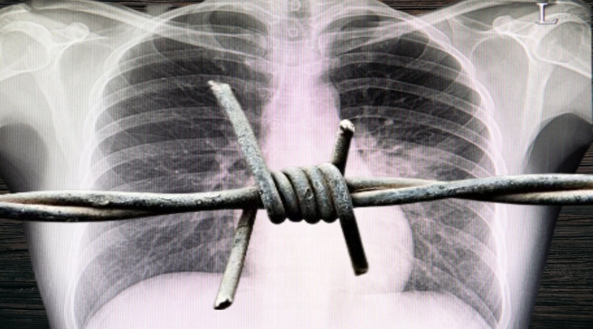 एक एक्स-रे रोक सकता था हिंदुस्तान का बंटवारा! CrimeTak