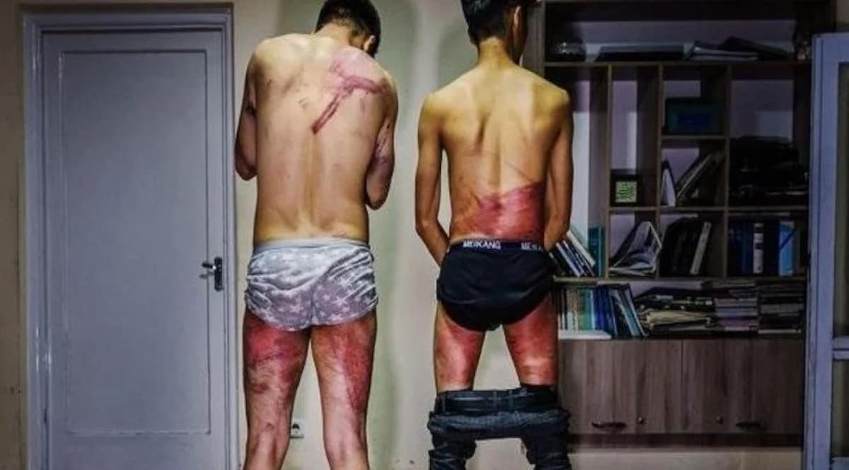 पत्रकारों के साथ तालिबान की बर्बरता की सामने आई तस्वीर, प्रदर्शन कर रहीं महिलाओं को भी पीटा CrimeTak