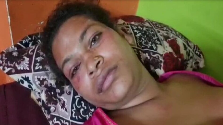 किन्नरों में खूनी संघर्ष !
दिल्ली में बीच सड़क पर जमकर हुआ हंगामा किन्नरों में खूनी संघर्ष !दिल्ली में बीच सड़क पर जमकर हुआ हंगामा