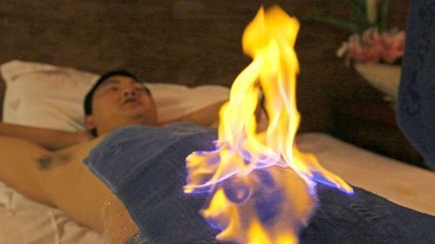 ये कैसा इलाज? यहां डॉक्टर अपने मरीज़ों को आग में झोंक देता है!