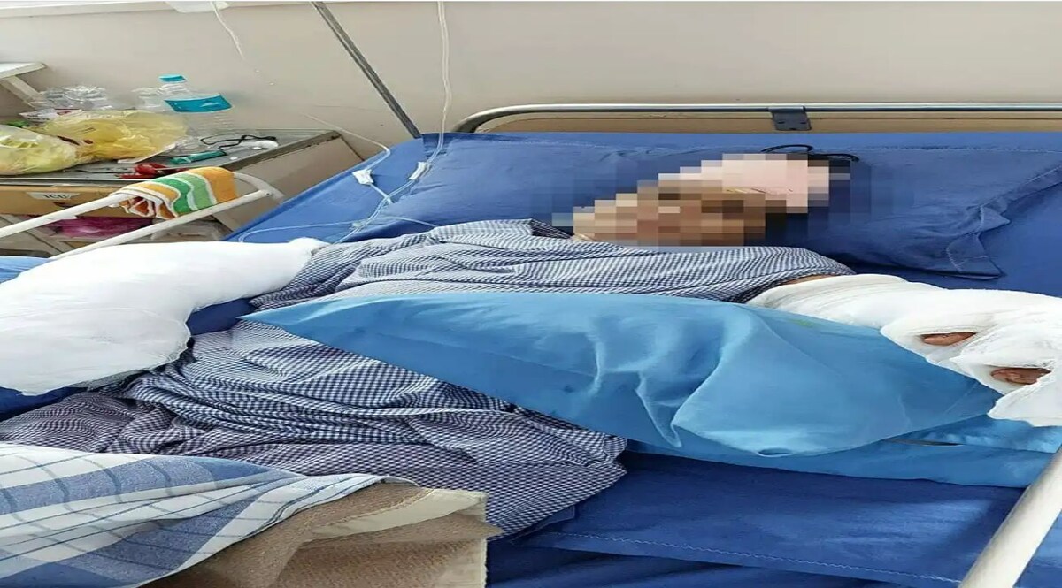 पढ़ाई और नौकरी की बात पर इस कदर नाराज हुआ ससुर, तलवार से काटे बहू के हाथ CrimeTak