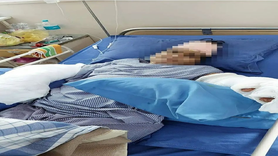 पढ़ाई और नौकरी की बात पर इस कदर नाराज हुआ ससुर, तलवार से काटे बहू के हाथ पढ़ाई और नौकरी की बात पर इस कदर नाराज हुआ ससुर, तलवार से काटे बहू के हाथ