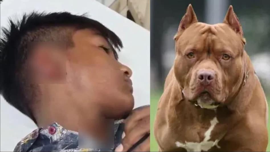 Pitbull Dog :13 साल के बच्चे पर पिटबुल ने किया हमला, चबा गया कान, पिता ने ऐसे बचाई जान Pitbull Dog :13 साल के बच्चे पर पिटबुल ने किया हमला, चबा गया कान, पिता ने ऐसे बचाई जान