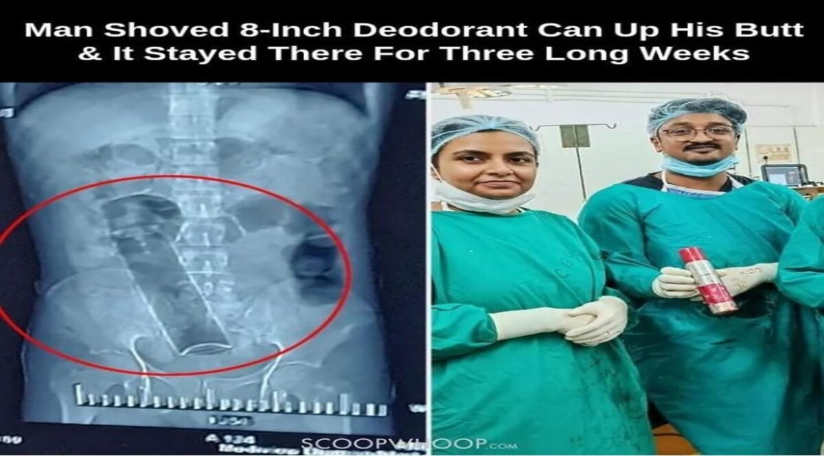 West Bengal News: ... अपने प्राइवेट पार्ट में डाल लिया Deodorant का सिलेंडर, ऐसे निकाला गया ? CrimeTak