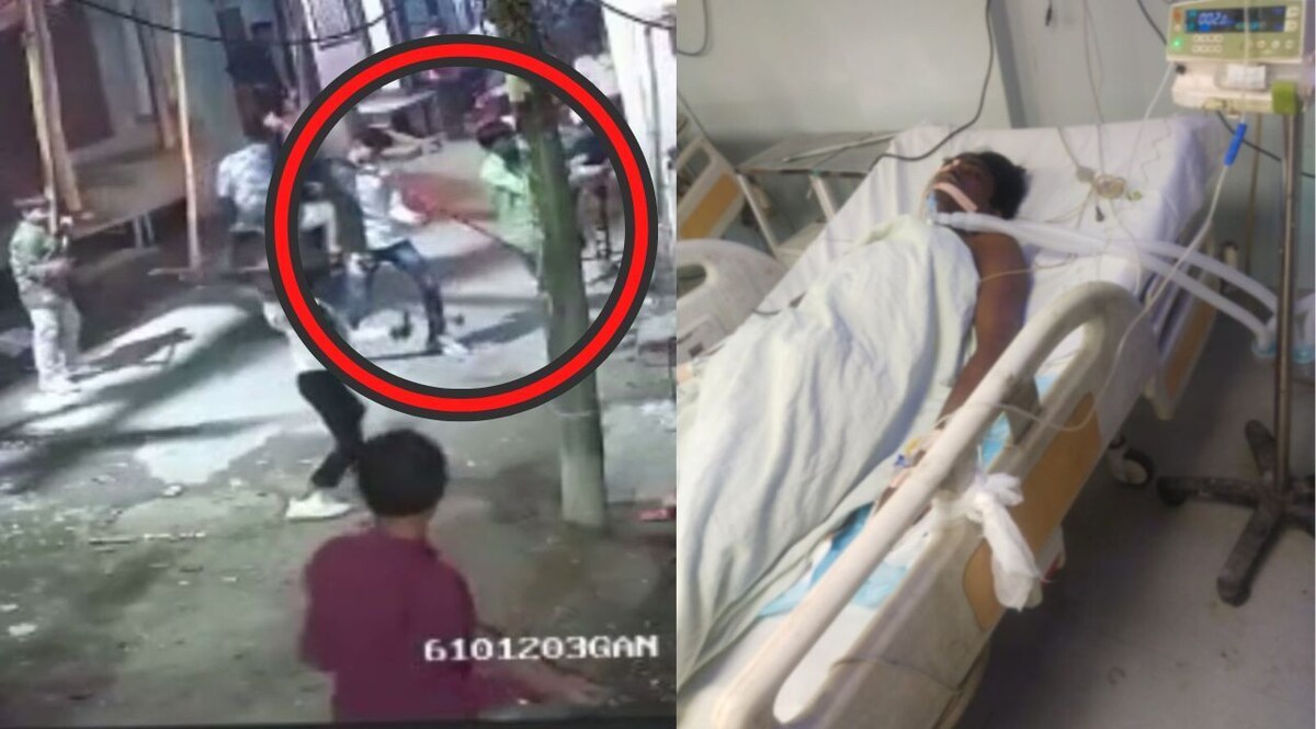 Delhi Crime: लोहे की नाल में भरा बारूद, युवक के प्राइवेट पार्ट में किया धमाका, सामने आया CCTV CrimeTak