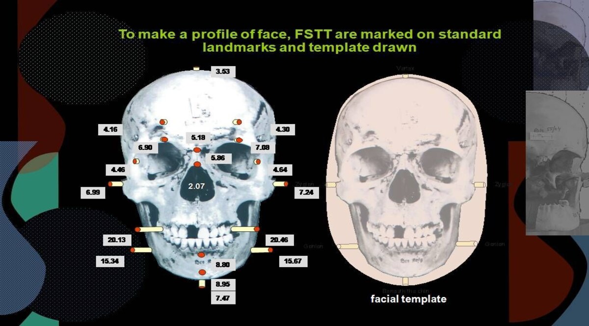 Delhi Crime: कंकाल खोपड़ी से खुलेगा क़त्ल का राज़, ये तकनीक एक खोपड़ी को देगी उसकी पहचान! CrimeTak