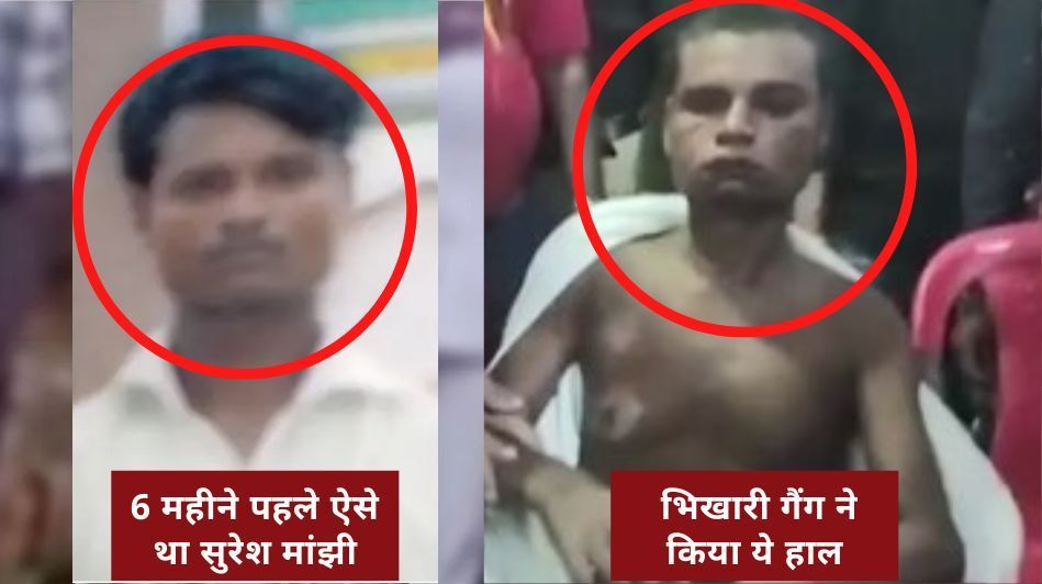 Bhikhari Gang : दिल्ली से मुंबई तक फैला है ये भिखारी गैंग, आंखें फोड़, अपाहिज बना मंगवाते हैं भीख