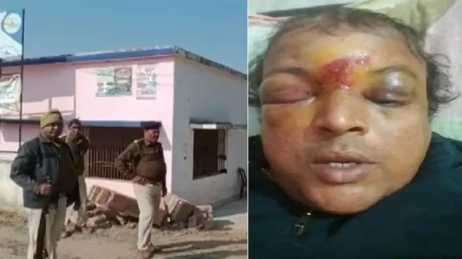 Bihar Crime : नकल करने से क्लास में रोका तो बाहर निकल छात्रों ने लाठी डंडे से पीट पूरा मुंह सूजा दिया Bihar Crime : नकल करने से क्लास में रोका तो बाहर निकल छात्रों ने लाठी डंडे से पीट पूरा मुंह सूजा दि...