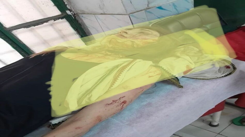 Foreigner Attacked: ऋषिकेश में युवक ने विदेशी महिला से की छेड़छाड़, सिर पर मारा पत्थर, आरोपी गिरफ्तार Foreigner Attacked: ऋषिकेश में युवक ने विदेशी महिला से की छेड़छाड़, सिर पर मारा पत्थर, आरोपी गिरफ्त...